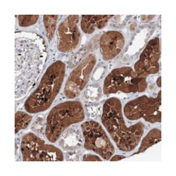 C1orf62 Rabbit anti-Human, Polyclonal Antibody, Abnova 100&mu;L; Unlabeled:Antibodies,