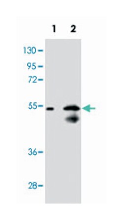 SLC29A1 Rabbit anti-Human, Mouse, Polyclonal Antibody, Abnova 400 &mu;L | Buy Online | Abnova Corporation | Fisher Scientific