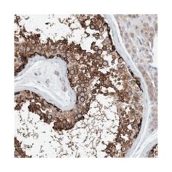 DYNC1LI1, Rabbit, Polyclonal Antibody, Abnova 100 &mu;L | Buy Online | Abnova Corporation | Fisher Scientific