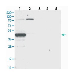 ABHD7, Rabbit, Polyclonal Antibody, Abnova 100 &mu;L | Buy Online | Abnova Corporation | Fisher Scientific