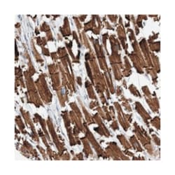 FAM26E, Rabbit, Polyclonal Antibody, Abnova 100&mu;L; Unlabeled:Antibodies,