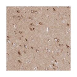 KLHL18 Rabbit anti-Human, Polyclonal Antibody, Abnova 100 &mu;L | Buy Online | Abnova Corporation | Fisher Scientific
