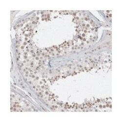 FAM217A, Rabbit, Polyclonal Antibody, Abnova 100 &mu;L | Buy Online | Abnova Corporation | Fisher Scientific