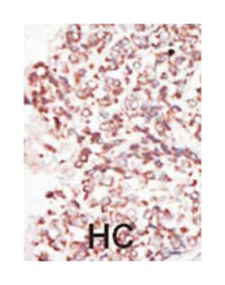 PIM2 Rabbit anti-Human, Polyclonal Antibody, Abnova 400&mu;L; Unlabeled:Antibodies,