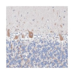 TANC1, Rabbit, Polyclonal Antibody, Abnova 100 &mu;L | Buy Online | Abnova Corporation | Fisher Scientific