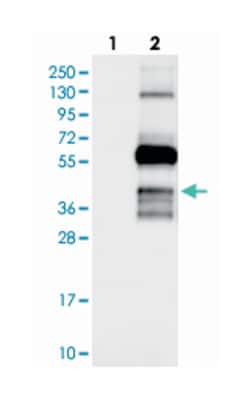 C10orf26, Rabbit, Polyclonal Antibody, Abnova 100 &mu;L | Buy Online | Abnova Corporation | Fisher Scientific