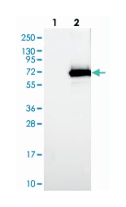 ACOT12 Rabbit anti-Human, Polyclonal Antibody, Abnova 100 &mu;L | Buy Online | Abnova Corporation | Fisher Scientific