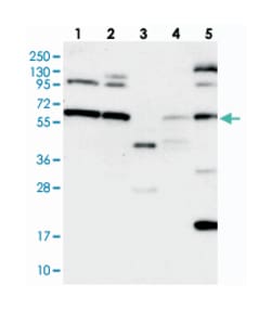 C12orf4, Rabbit, Polyclonal Antibody, Abnova 100 &mu;L | Buy Online | Abnova Corporation | Fisher Scientific