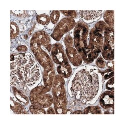C10orf67, Rabbit, Polyclonal Antibody, Abnova 100 &mu;L | Buy Online | Abnova Corporation | Fisher Scientific