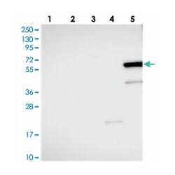 ZNF45, Rabbit, Polyclonal Antibody, Abnova 100 &mu;L | Buy Online | Abnova Corporation | Fisher Scientific