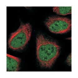 ANKRD12, Rabbit, Polyclonal Antibody, Abnova 100&mu;L; Unlabeled:Antibodies,