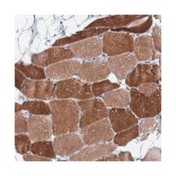 TRDN, Rabbit, Polyclonal Antibody, Abnova 100&mu;L; Unlabeled:Antibodies