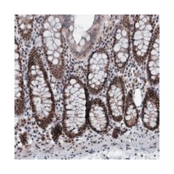 GALNT11, Rabbit, Polyclonal Antibody, Abnova 100 &mu;L | Buy Online | Abnova Corporation | Fisher Scientific