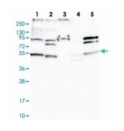 STAMBPL1, Rabbit, Polyclonal Antibody, Abnova 100 &mu;L | Buy Online | Abnova Corporation | Fisher Scientific