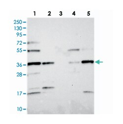 FAM118B Rabbit anti-Human, Polyclonal Antibody, Abnova 100 &mu;L | Buy Online | Abnova Corporation | Fisher Scientific