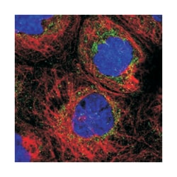 NDUFB9 Rabbit anti-Human, Polyclonal Antibody, Abnova 100 &mu;L | Buy Online | Abnova | Fisher Scientific