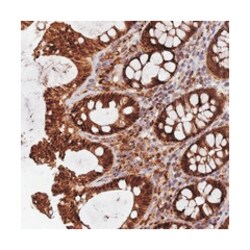 PODNL1, Rabbit, Polyclonal Antibody, Abnova 100 &mu;L | Buy Online | Abnova Corporation | Fisher Scientific