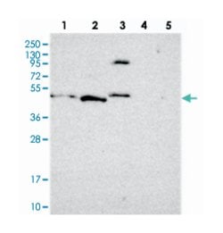 FBRS, Rabbit, Polyclonal Antibody, Abnova 100&mu;L; Unlabeled:Antibodies,