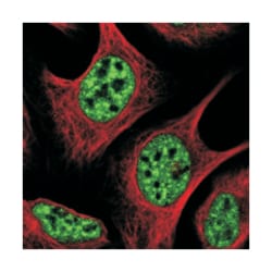 AP5Z1, Rabbit, Polyclonal Antibody, Abnova 100&mu;L; Unlabeled:Antibodies,