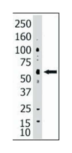 SENP2 Rabbit anti-Human, Polyclonal Antibody, Abnova 400&mu;L; Unlabeled:Antibodies,
