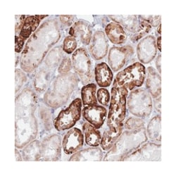 C6orf163, Rabbit, Polyclonal Antibody, Abnova 100 &mu;L | Buy Online | Abnova Corporation | Fisher Scientific