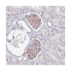 UBXN2B, Rabbit, Polyclonal Antibody, Abnova 100 &mu;L | Buy Online | Abnova Corporation | Fisher Scientific
