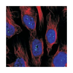 NOVA2, Rabbit, Polyclonal Antibody, Abnova 100&mu;L; Unlabeled:Antibodies,