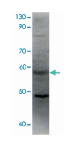 F2rl2, Rabbit, Polyclonal Antibody, Abnova 100 &mu;g | Buy Online | Abnova Corporation | Fisher Scientific