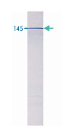 Pde3b, Goat, Polyclonal Antibody, Abnova 100 &mu;g | Buy Online | Abnova Corporation | Fisher Scientific