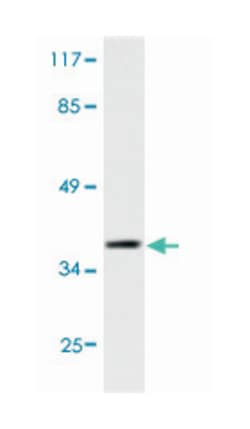 XRCC3 Rabbit anti-Human, Polyclonal Antibody, Abnova 100&mu;L; Unlabeled:Antibodies,
