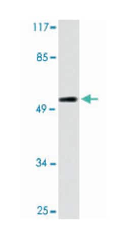 CYP2A6, Rabbit, Polyclonal Antibody, Abnova 100 &mu;L | Buy Online | Abnova Corporation | Fisher Scientific