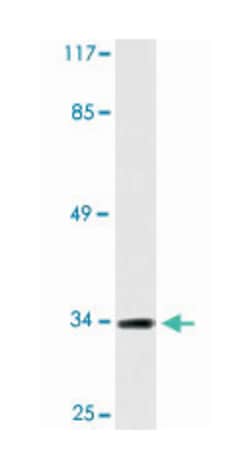 CCBP2 Rabbit anti-Human, Polyclonal Antibody, Abnova 100&mu;L; Unlabeled:Antibodies,