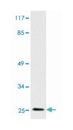 IGLL1 Rabbit anti-Human, Polyclonal Antibody, Abnova 100 &mu;L | Buy Online | Abnova | Fisher Scientific