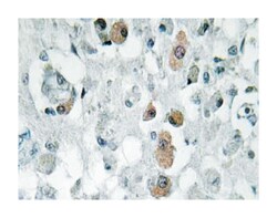 GNPAT, Rabbit, Polyclonal Antibody, Abnova 100 &mu;L | Buy Online | Abnova Corporation | Fisher Scientific