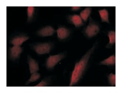 GATA1 (phospho S310), Rabbit anti-Human, Mouse, Rat, Polyclonal Antibody, Abnova 100 &mu;g | Buy Online | Abnova Corporation | Fisher Scientific
