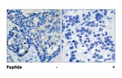 PTK2B (phospho Y402), Rabbit anti-Human, Mouse, Rat, Polyclonal Antibody,