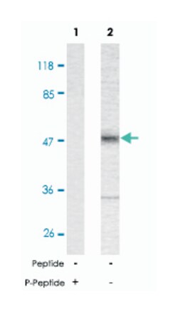 MAPT (phospho T181), Rabbit anti-Human, Mouse, Rat, Polyclonal Antibody, Abnova 100 &mu;g | Buy Online | Abnova Corporation | Fisher Scientific