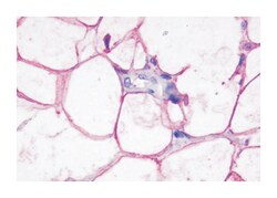 ADRB3 Rabbit anti-Human, Polyclonal Antibody, Abnova 50&mu;g; Unlabeled:Antibodies,