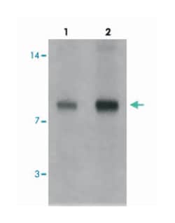 SELK, Rabbit, Polyclonal Antibody, Abnova 100&mu;g; Unlabeled:Antibodies,