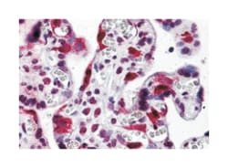 LZTS2 Rabbit anti-Human, Polyclonal Antibody, Abnova 100 &mu;g | Buy Online | Abnova Corporation | Fisher Scientific