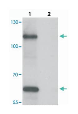 SIK3, Chicken, Polyclonal Antibody, Abnova 100&mu;g; Unlabeled:Antibodies,