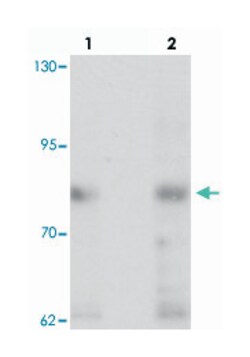 FCHSD1, Chicken, Polyclonal Antibody, Abnova 100 &mu;g | Buy Online | Abnova | Fisher Scientific