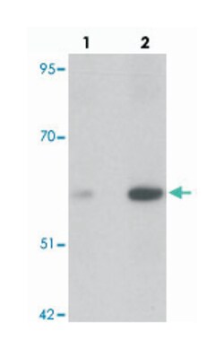 ANGPT2 Rabbit anti-Human, Mouse, Rat, Polyclonal Antibody, Abnova 100&mu;g;
