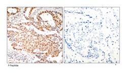 MEF2A (phospho S408), Rabbit anti-Human, Mouse, Rat, Polyclonal Antibody,