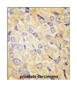 FZD1 Rabbit anti-Human, Polyclonal Antibody, Abnova 400 &mu;L | Buy Online | Abnova Corporation | Fisher Scientific