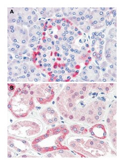 CADM4, Rabbit, Polyclonal Antibody, Abnova 50 &mu;g | Buy Online | Abnova Corporation | Fisher Scientific