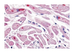 CXCR4 Rabbit anti-Bovine, Dog, Hamster, Horse, Human, Monkey, Mouse, Pig, Rat, Sheep, Polyclonal Antibody, Abnova 50 &mu;g | Buy Online | Abnova Corporation | Fisher Scientific