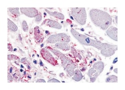CXCR4 Rabbit anti-Bovine, Dog, Hamster, Horse, Human, Monkey, Mouse, Pig, Rabbit, Rat, Polyclonal Antibody, Abnova 50 &mu;g | Buy Online | Abnova Corporation | Fisher Scientific