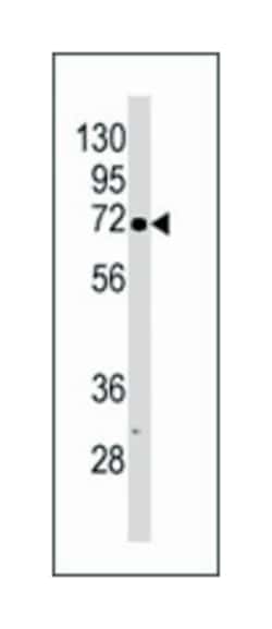 CDKL2 Rabbit anti-Human, Polyclonal Antibody, Abnova 400&mu;L; Unlabeled:Antibodies,