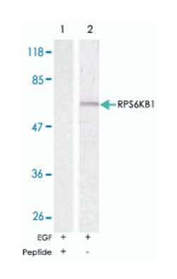 RPS6KB1 Rabbit anti-Human, Mouse, Rat, Polyclonal Antibody, Abnova 100 &mu;g | Buy Online | Abnova Corporation | Fisher Scientific
